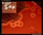 Pseudomonas aeruginosa